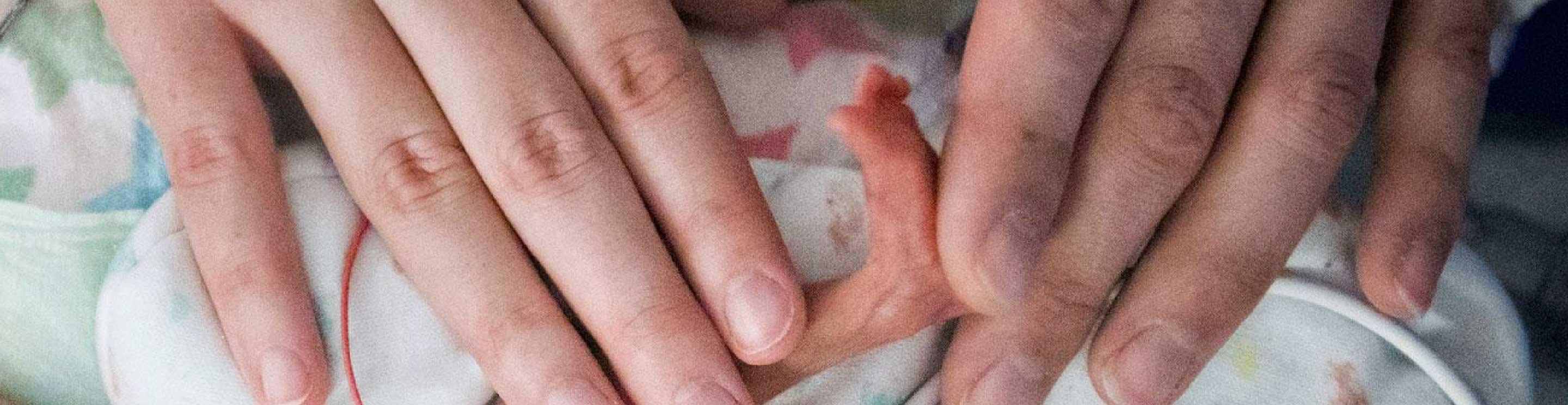Ella, IWK Patient