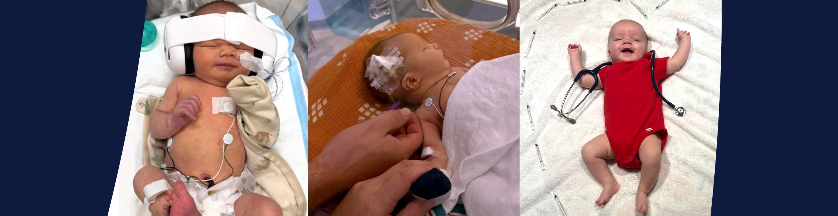 Three photos showing Theodore's recovery and growth