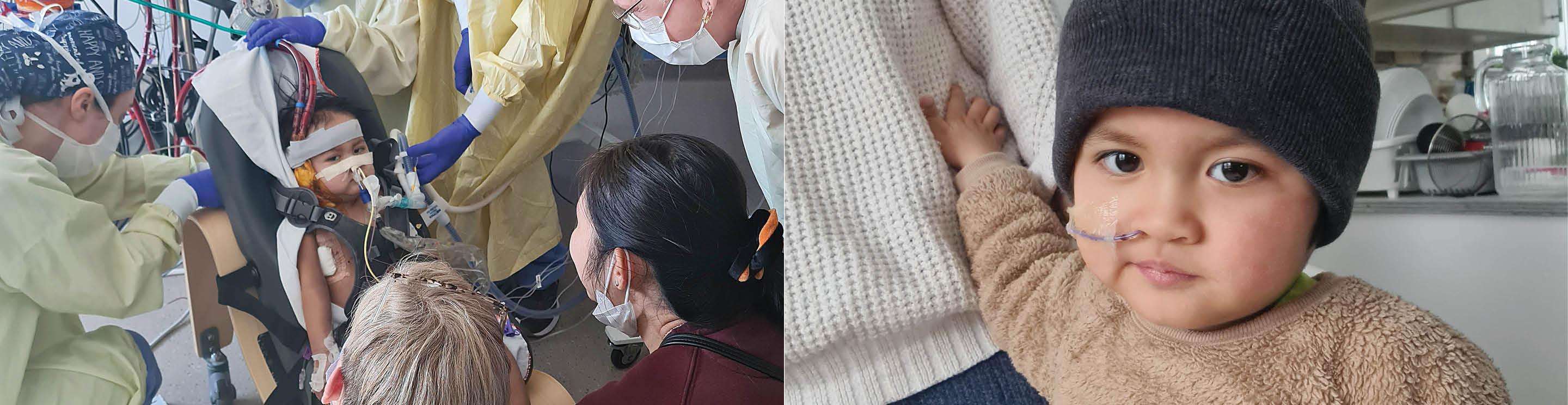 Johnny receiving hospital care, alongside a close-up with a nasal tube holding an adult’s hand.