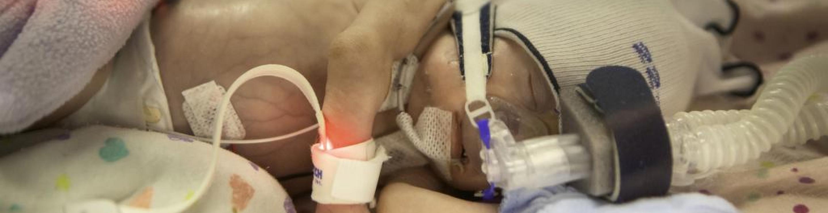 Paizlee  Rose Adams, IWK patient