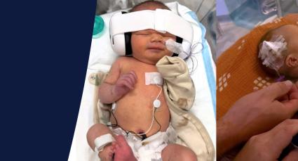 Three photos showing Theodore's recovery and growth