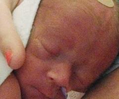 Grady, IWK Patient