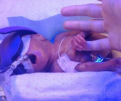 Rory, IWK patient