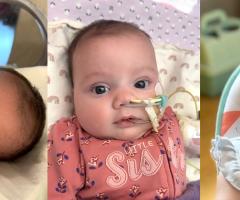 Four photos showing a baby girl’s journey from newborn in hospital care with tubes to a smiling, healthy toddler wearing a pink sun hat.