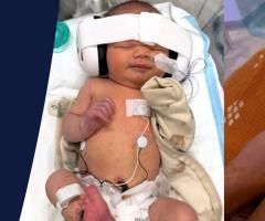 Three photos showing Theodore's recovery and growth